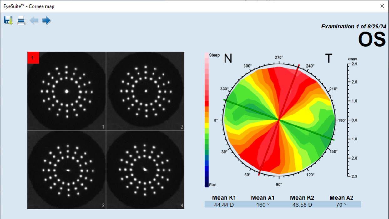 HS_lenstar_ps_7220460_bio_detv